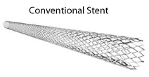 old stent